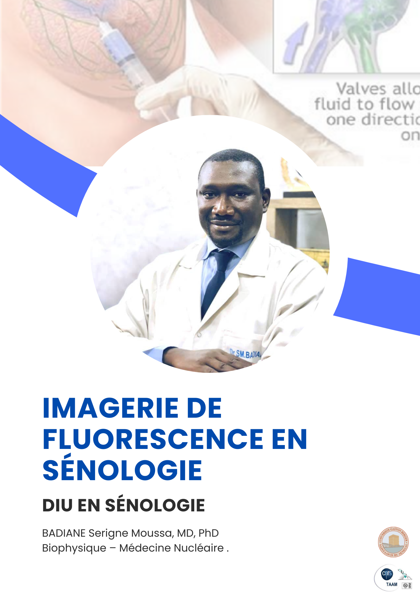 Imagerie de fluorescence DIU en sénologie, BADIANE SERIGNE MOUSSA